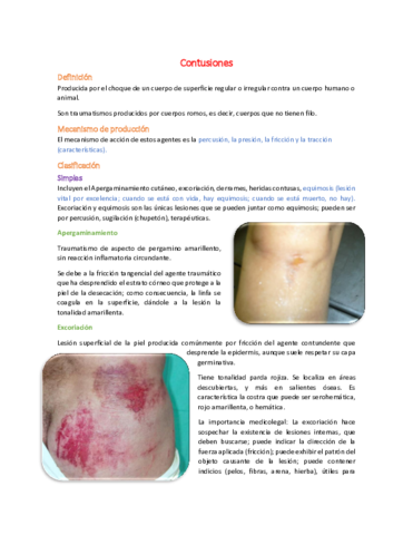 Wuolah | Descarga 5 - Contusiones.pdf - Apuntes de Medicina Legal